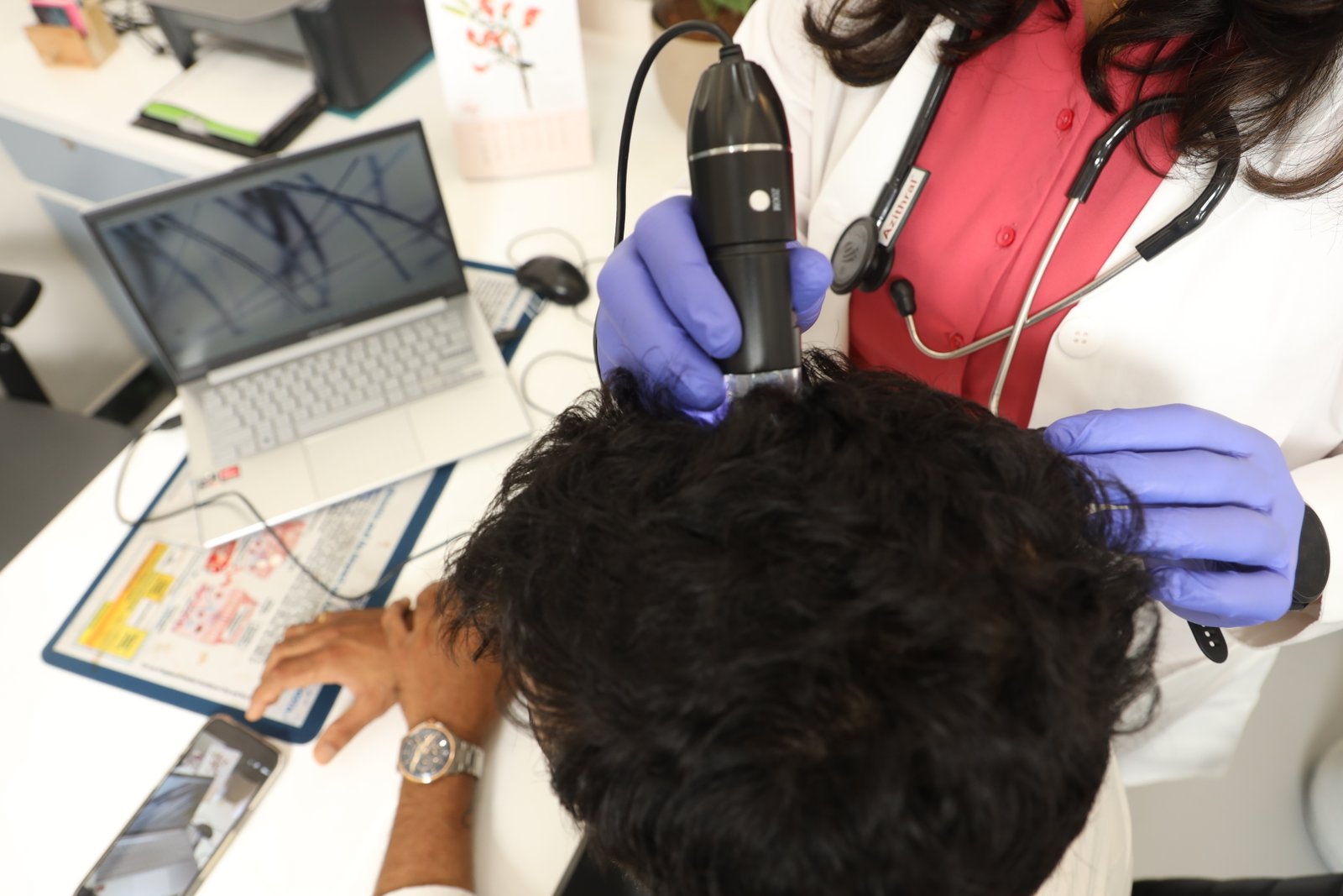 Clinician examining the scalp for dandruff treatment